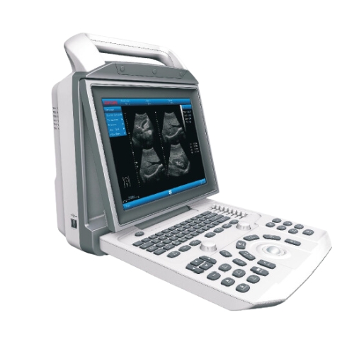 VIV20 High End Ultrasound Machine Zoncare